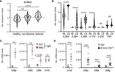 IL-17A-driven psoriasis is critically dependent on IL-36 signaling